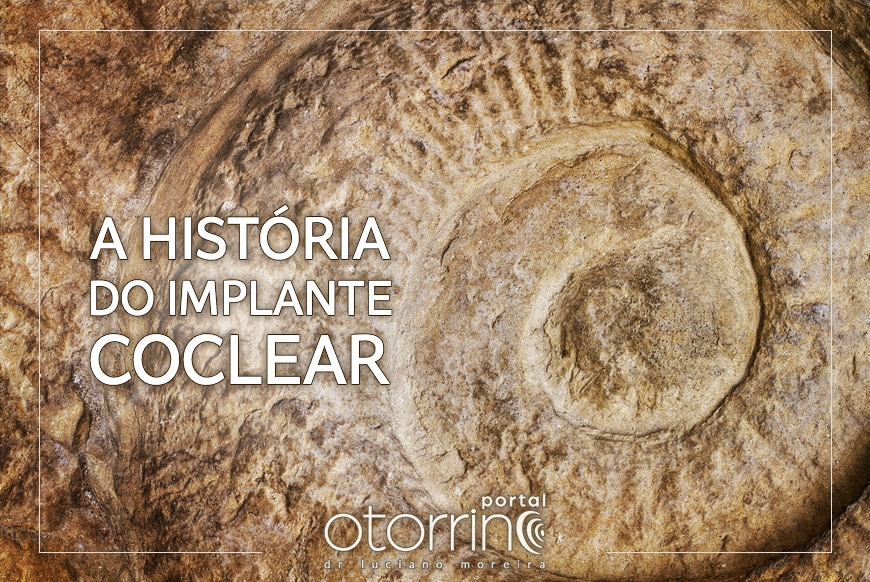 cochlear implant history