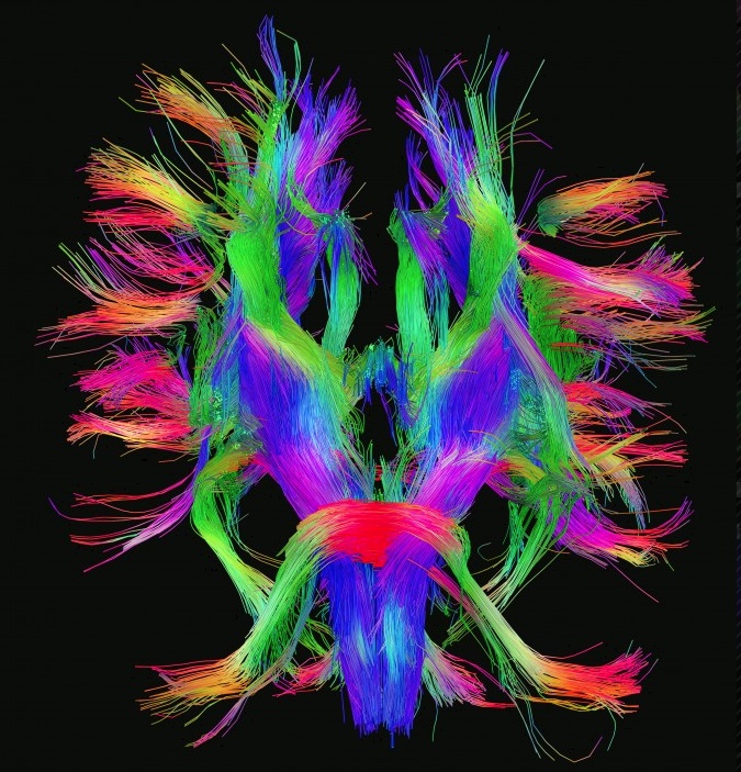 conectoma cerebral