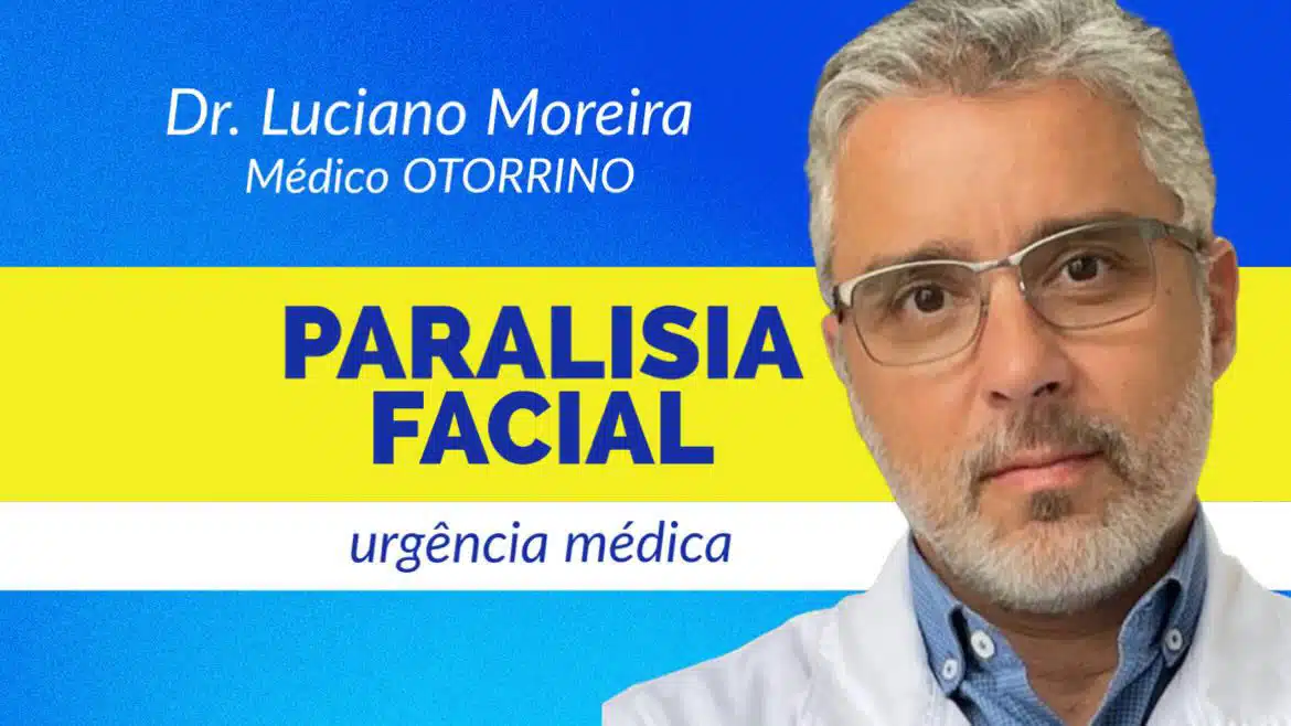 paralisia facial