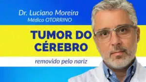 tumor do cerebro removido pelo nariz dr luciano moreira otorrino