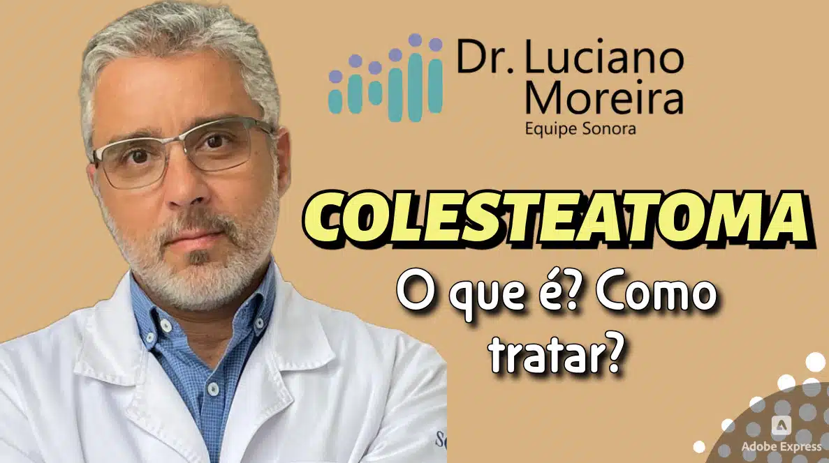 o que e colesteatoma e como tratar dr. luciano moreira